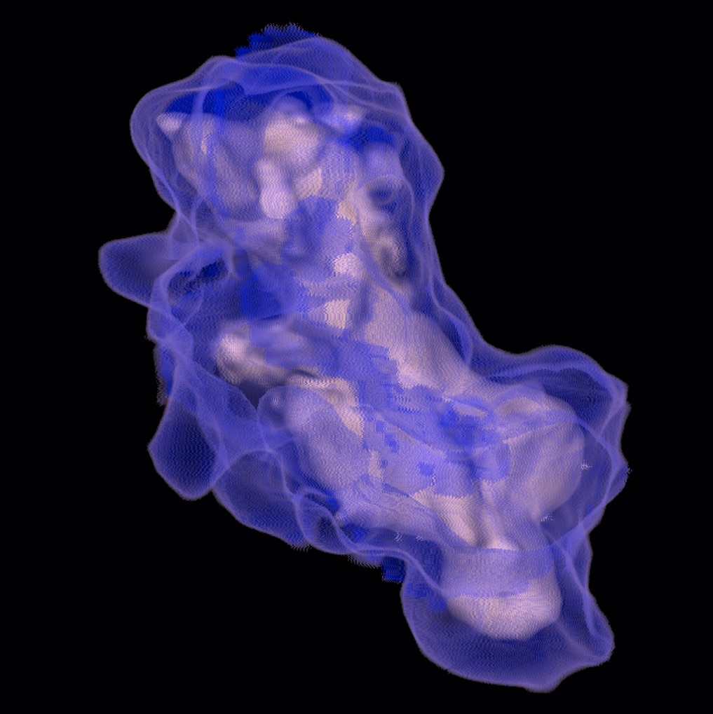 visualisation avancée lung vcar.